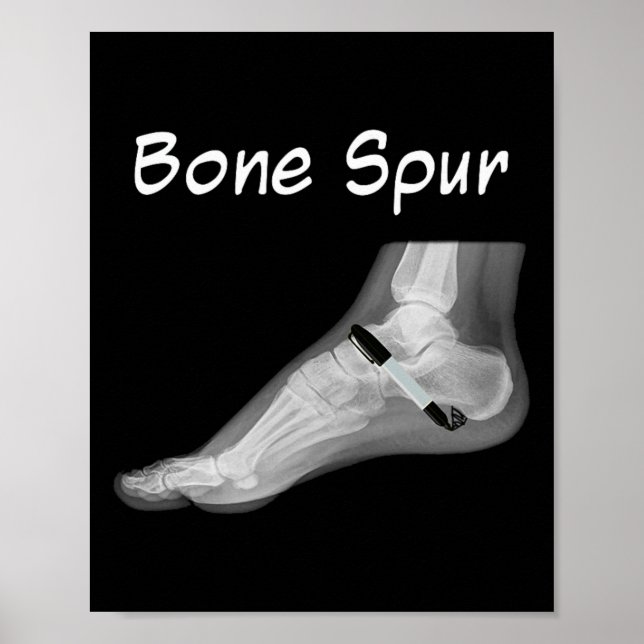 Trump Bone Spur Ink Pen Funny Anti Trump  Poster (Vorne)