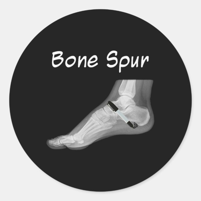 Trump Bone Spur Ink Pen Funny Anti Trump  Runder Aufkleber (Vorderseite)