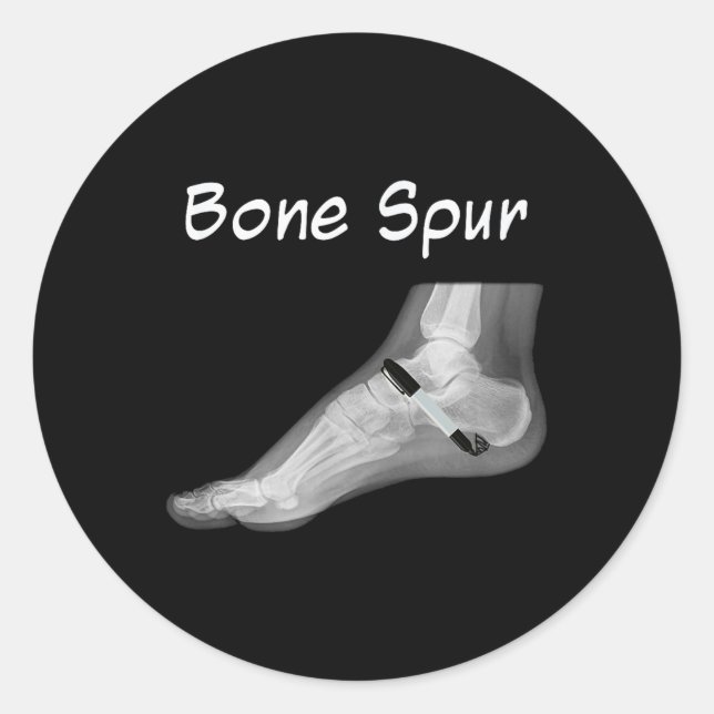 Trump Knochenspur Tink Pen Funny Anti Trump Runder Aufkleber (Vorderseite)