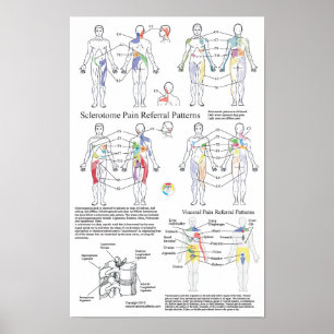 Übersicht über die visuelle Schmerzdarstellung im  Poster