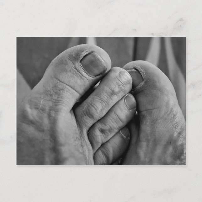 Ugly Feet Postkarte (Vorderseite)