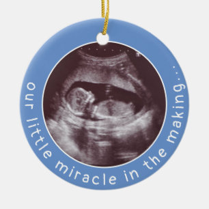 Ultrasound Foto Baby Boy Blue Wunder Making I Keramik Ornament
