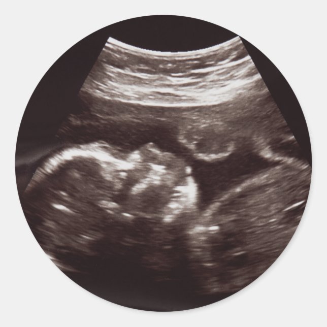 Ultrasound Foto Babydusche Danke Siegel Runder Aufkleber (Vorderseite)