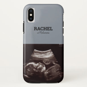 Ultrasound Foto Dusty Blue Monogram Case-Mate iPhone Hülle