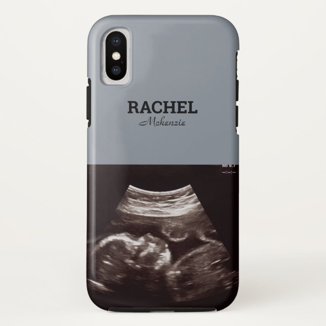 Ultrasound Foto Dusty Blue Monogram Case-Mate iPhone Hülle (Rückseite)