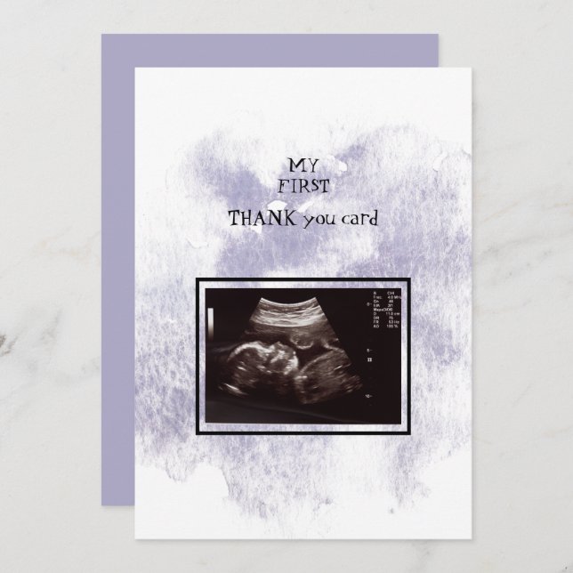 Ultrasound Girl Vielen Dank Baby Point-Ansicht Dankeskarte (Vorne/Hinten)