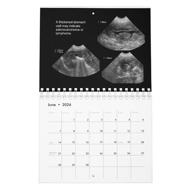 Ultrasound Kalender (Jun 2026)