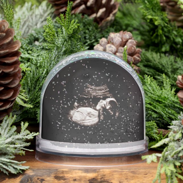 Ultrasound Snow Globe Schneekugeln (Winter)