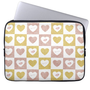 Umarmung Laptopschutzhülle