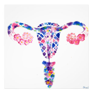 Uterus Fotodruck