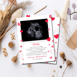 Valentine to Daddy from Bump