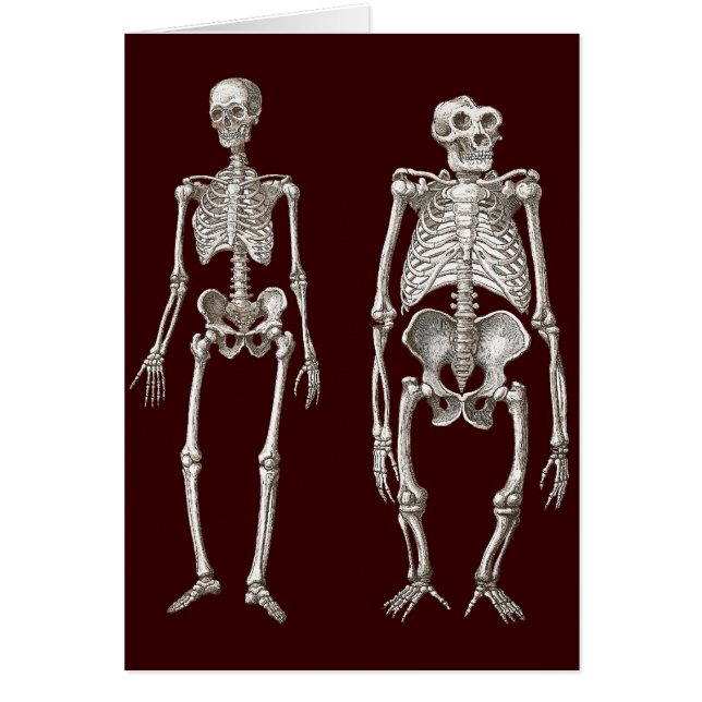 Vermisste Verbindung - Skelette des Mannes und des (Vorne)