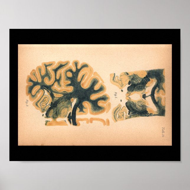 Vintag 1901 Gehirnanatomie drucken Poster (Vorne)