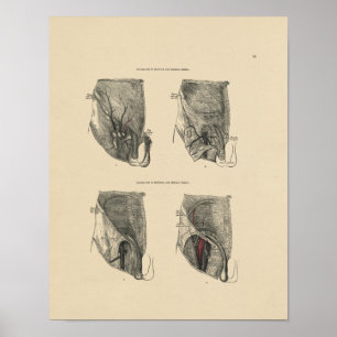 Vintag Hernia Anatomy 1880 Print Poster