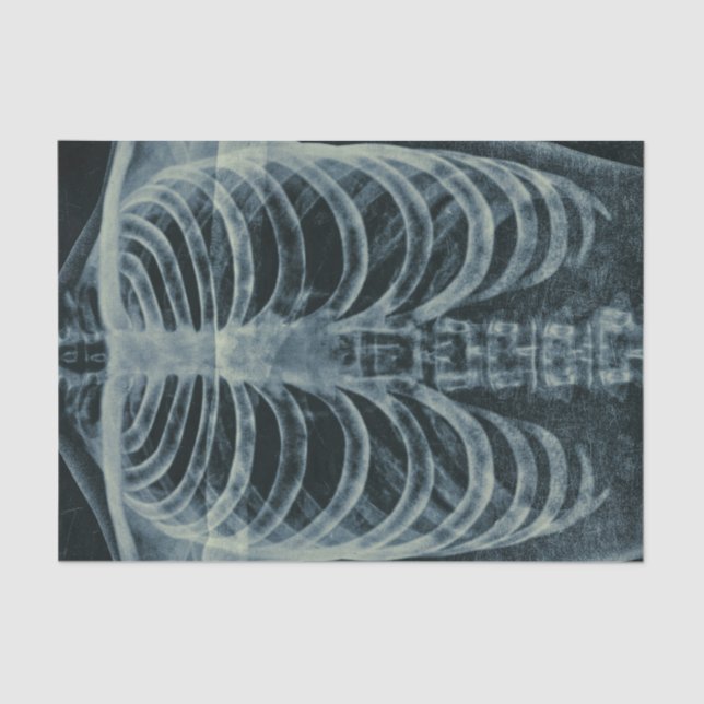 Vintag Schwarz-Weiß-Skelett-Röntgen Seidenpapier (Vorderseite)