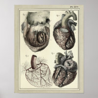 Vintage 1831 Herz-Arterien Anatomie drucken