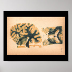 Vintage 1901 Brain Anatomy Print Poster