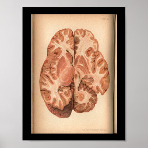 Vintage 1901 Brain Anatomy Print Poster