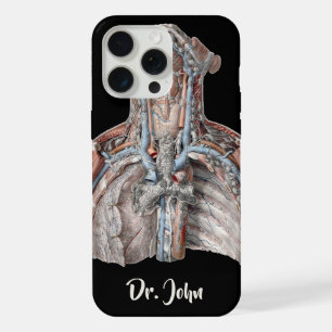 Vintage menschliche Anatomie Kehle, Hals, Brust, R iPhone Hülle