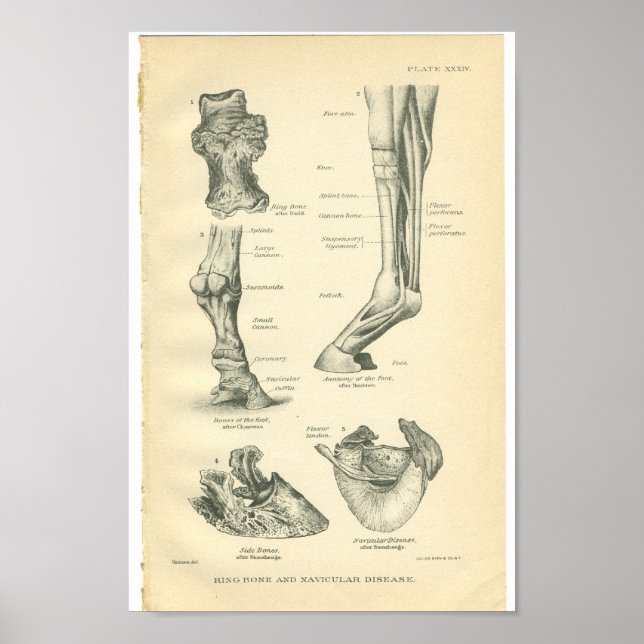 Vintager Anatomie der Druckring Poster (Vorne)