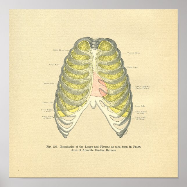 Vintager Frohse Anatomische Lungenspalte Poster (Vorne)