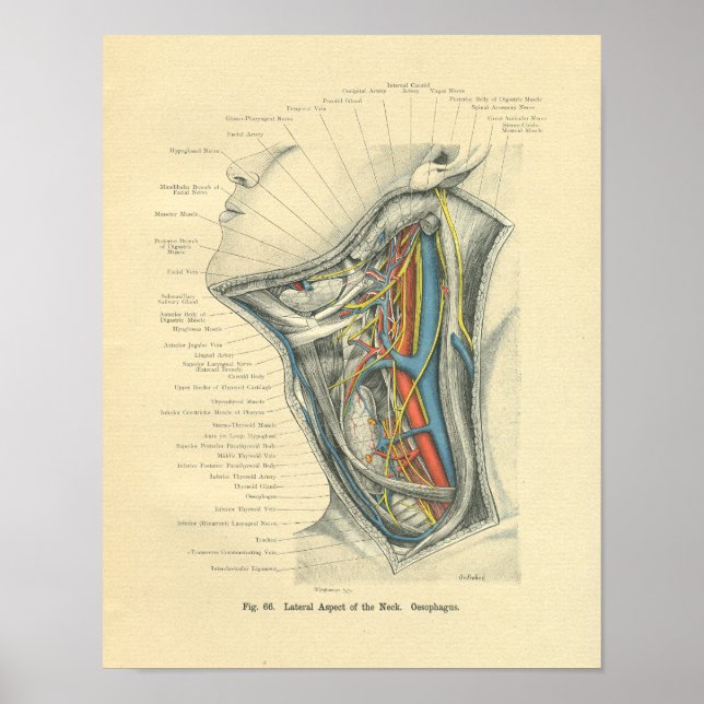 Vintager Frohse Anatomischer Lateraler Neck Poster (Vorne)