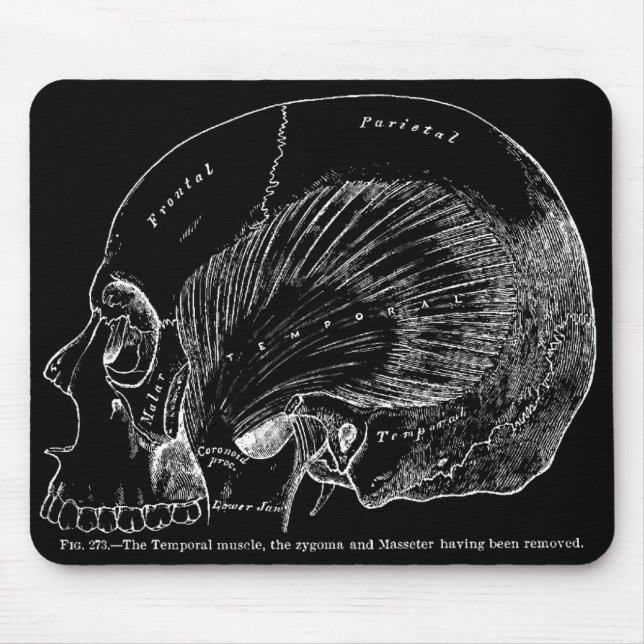 Vintager medizinischer zeichnender menschlicher mousepad (Vorne)