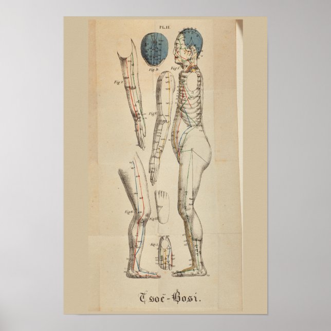 Vintages Französisch 1825 Akupunktur Meridian Punk Poster (Vorne)