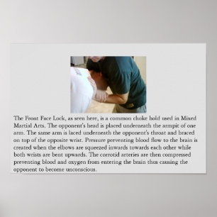 Vordere Feststelltaste oder Vorderschloss Poster