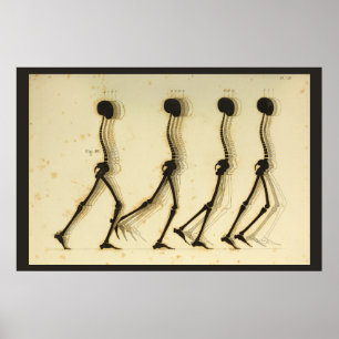 Wanderung Gait Analysis Leg Spine Chiropractic Cha Poster