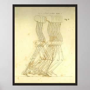 Wanderung Gait Analysis Leg Spine Chiropractic Cha Poster
