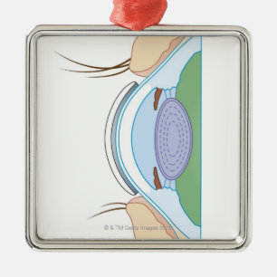 Weiche Kontaktlinse Ornament Aus Metall