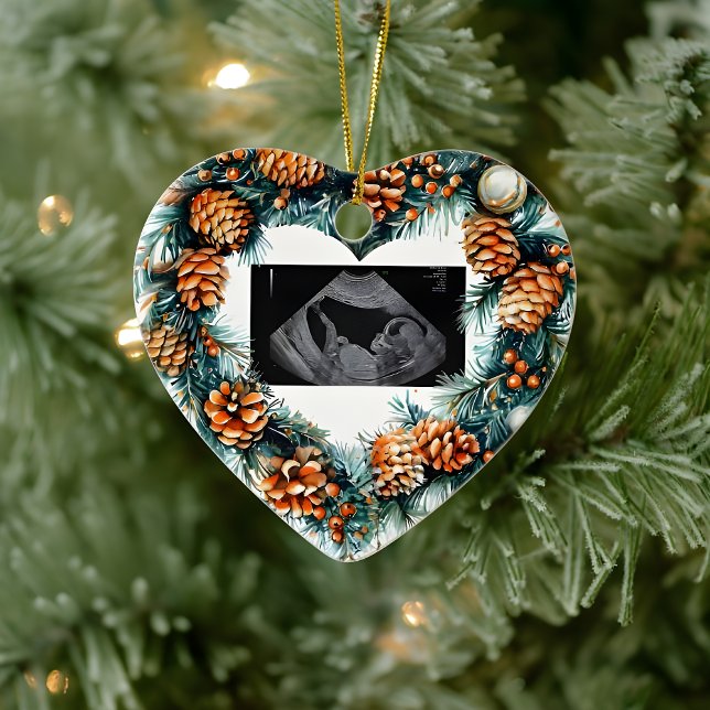 Weihnachts-Schwangerschaft-Ultraschall  Baby ist u Keramik Ornament (Von Creator hochgeladen)