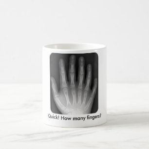 Wieviele Finger? Röntgenstrahl Kaffeetasse