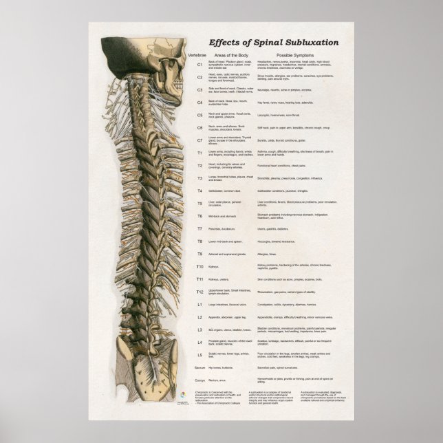 Wirkungen des Spinal Subluxation Poster Chiroprakt (Vorne)