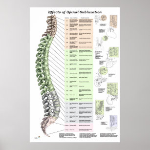 Wirkungen des Spinal Subluxation Poster Chiroprakt