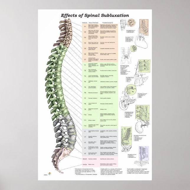 Wirkungen des Spinal Subluxation Poster Chiroprakt (Vorne)