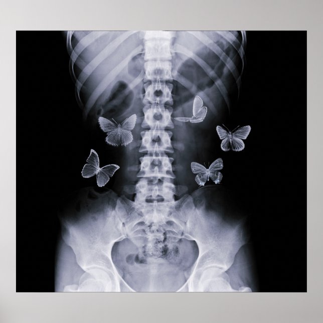 X-Ray Anticipatory Conceptual Butterflies Poster (Vorne)