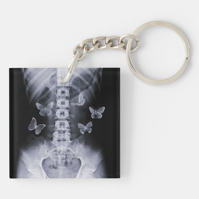 X-Ray Conceptual Butterflies Keychain Schlüsselanhänger (Rückseite)