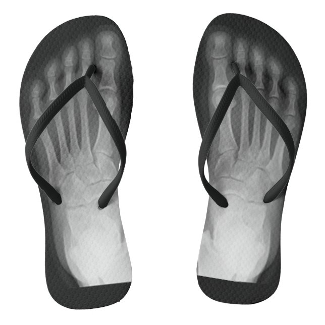 X-Ray Feet! Flip Flops (Fußbett)