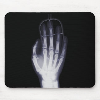 X-Ray Mousepad
