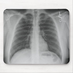 X-Ray Mousepad
