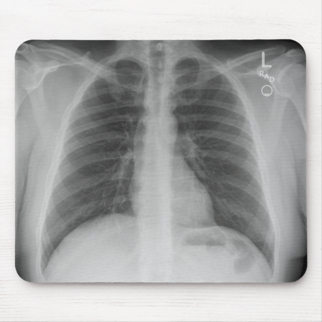 X-Ray Mousepad (Vorne)