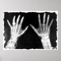 X-Ray Skeleton Hands & Schmuck - B&W