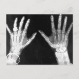 X-Ray Skeleton Hands & Schmuck - B&W Postkarte