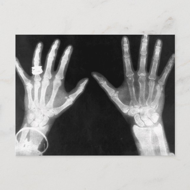 X-Ray Skeleton Hands & Schmuck - B&W Postkarte (Vorderseite)