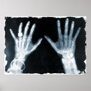 X-Ray Skeleton Hands & Schmuck - Blau Poster