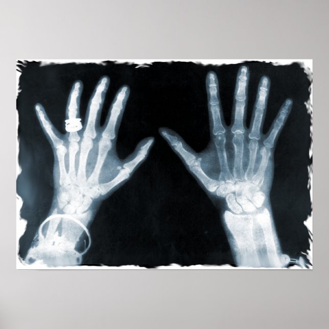 X-Ray Skeleton Hands & Schmuck - Blau Poster (Vorne)