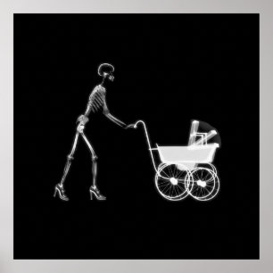X-Ray Skeleton Mama & Baby - Original B&W Poster