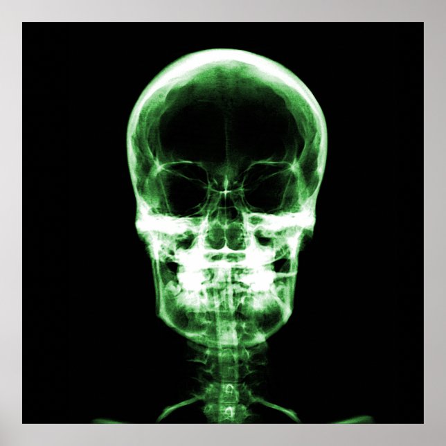 X-Ray Skeleton Skull - Green Poster (Vorne)